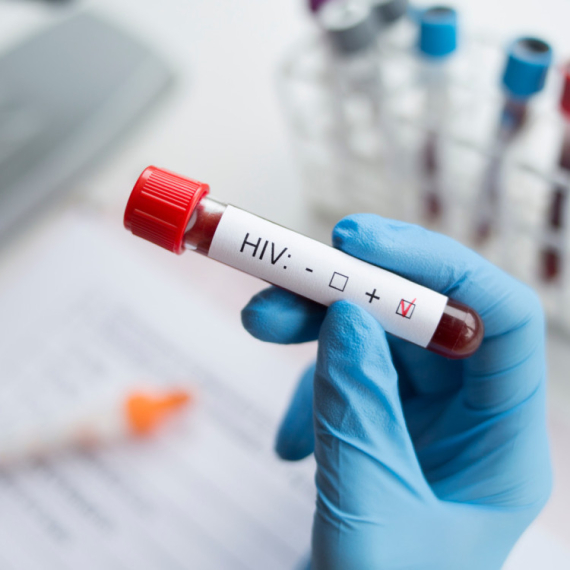 Evropska nedelja testiranja na HIV i hepatitise: Od danas do 26. maja FOTO