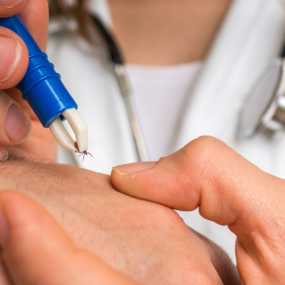 Doktorka savetuje: "Jednu stvar nikako nemojte da radite kada primetite krpelja"