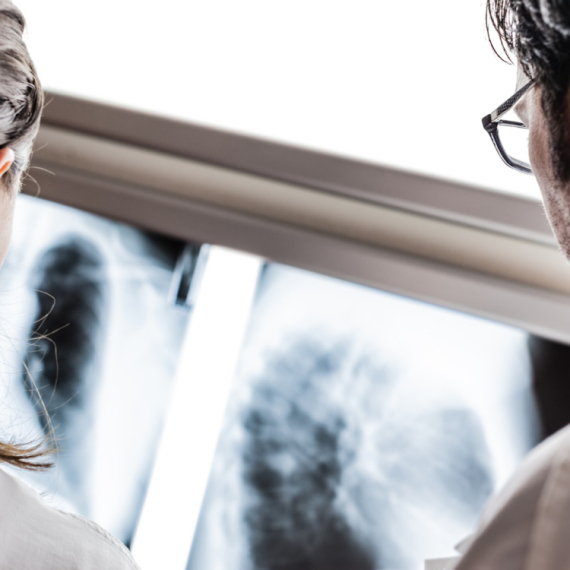 Jednostavan test koji može da otkrije opaku bolest VIDEO