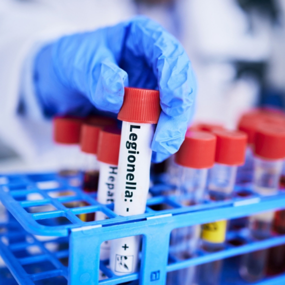 Opasnom bakterijom se zarazili u teretani? FOTO