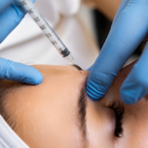 Besplatan botoks izazvao haos u Duizburgu: Lekari upozoravaju na opasne posledice