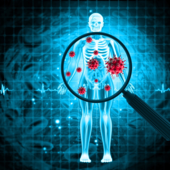 Hronične bolesti tihi ubica modernog doba: Lekar savetuje šta je potrebno promeniti u životu VIDEO