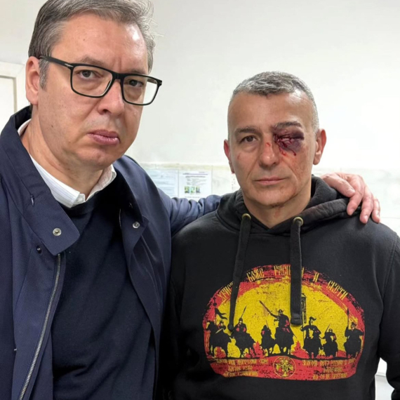 Vučić o napadu na policajca: Jezivo je povređen, ima teške telesne povrede FOTO