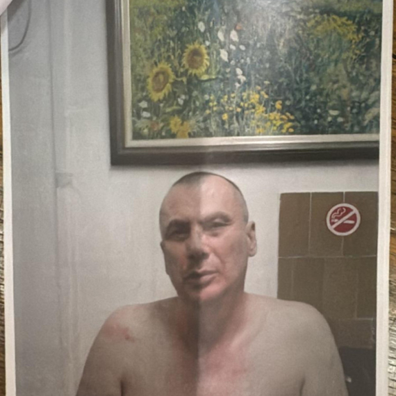 Mediji: Tortura policije, advokat zbog psovke prebijen; Zašto su napadači na dekana Drida na slobodi? FOTO