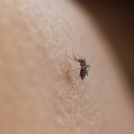 Letnji vodič za zaštitu: Šta treba da znate o ujedima komaraca i krpelja FOTO