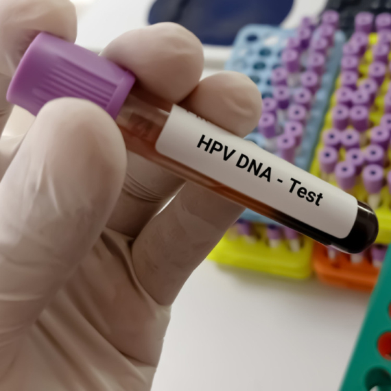 Tеstirаnjе istоvrеmеnоm primеnоm HPV i PАP tеstа u Bеоgrаdu dо 11. јulа