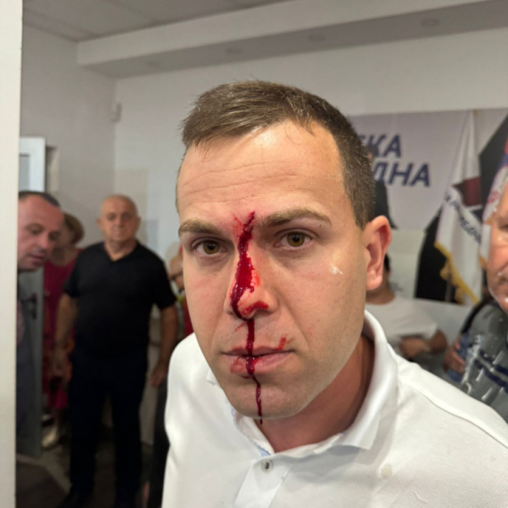 Povređena tri člana SNS: Oglasio se Opštinski odbor u Lazarevcu povodom jezivog nasilja blokadera