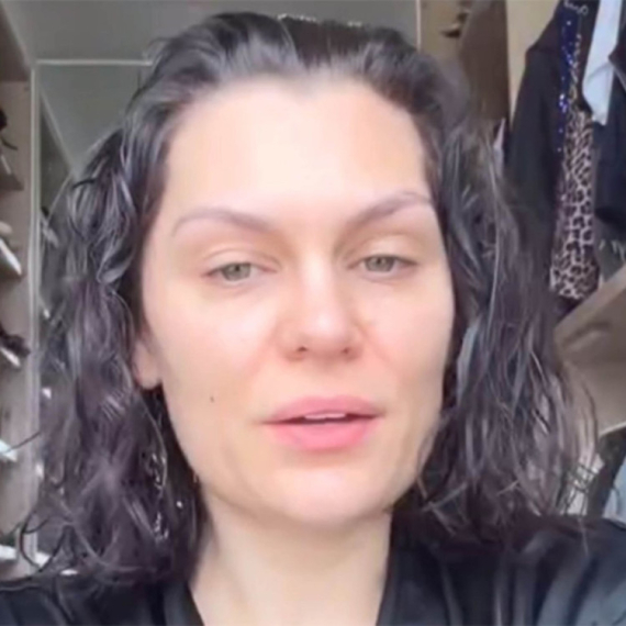 Pevačica progovorila o posledicama posle odstranjivanja dojke: "Kosa mi opada kao luda, a grudi..." VIDEO