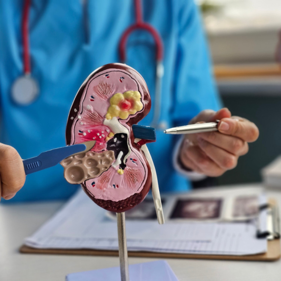 Podvig naučnika: Izvršili transplantaciju kombinovanjem organoida bubrega svinje i čoveka