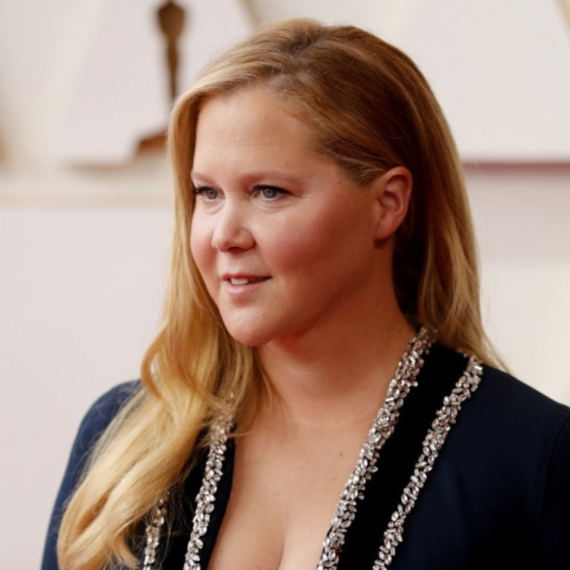 Poznata glumica boluje od Kušingovog sindroma: Evo kako se ispoljava ovo retko stanje