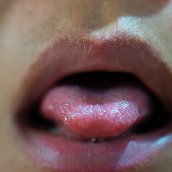 Poznatoj influenserki posle jednog poljupca pukao jezika na dva dela: Završila u bolnici posle sastanka