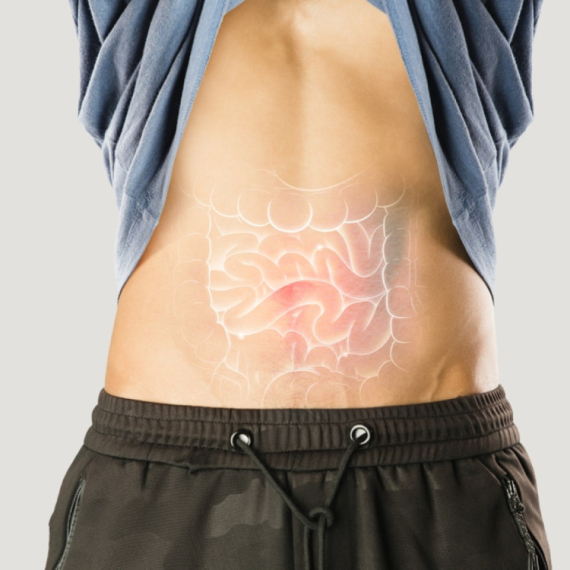 Creva kao pivara: Retka bolest opija bez pića, glavni krivci su bakterije FOTO