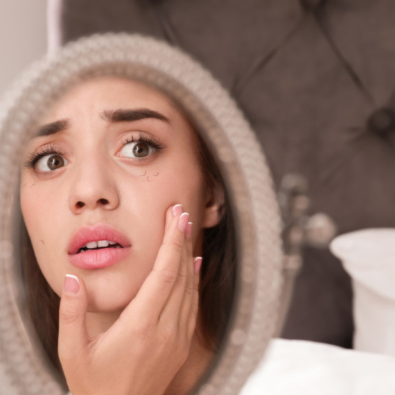 Ako vam trepavice preterano opadaju, ne ignorišite: Mogući znak ozbiljnog zdravstvenog problema