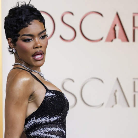 Spektakl na crvenom tepihu; Pristižu najveće zvezde: Trka za nagrade nikad neizvesnija  FOTO