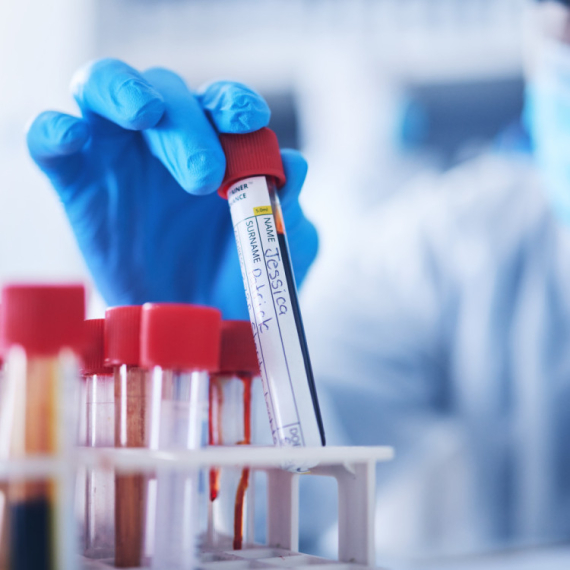 Ovo oboljenje je najčešći uzrok srčanog i moždanog udara