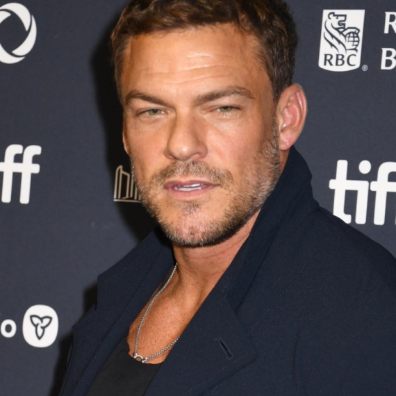 Novi detalji tuče poznatog glumca: Oglasila se policija