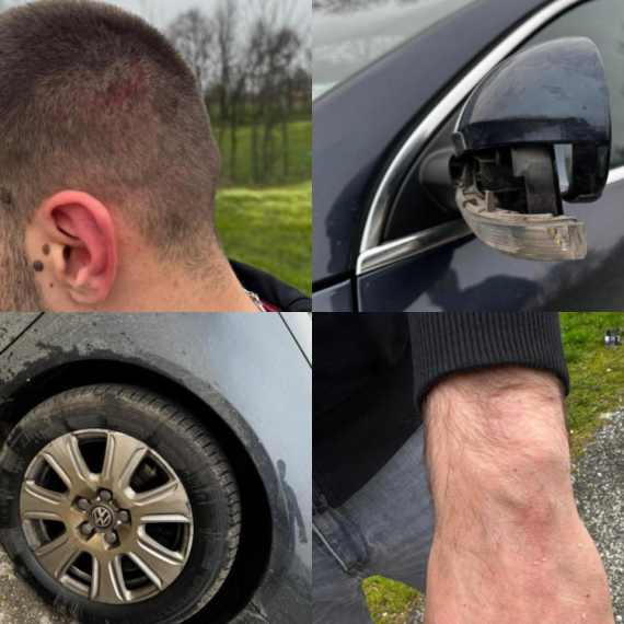 Oglasio se MUP: Privedeno 15 osoba; Sumnja se da su napali aktivistu SNS u selu Ratar – imali hladno oružje