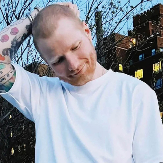 Ed Širan otkiro da je morao da se ošiša zbog bolesti: "Sada se oporavljam..." FOTO