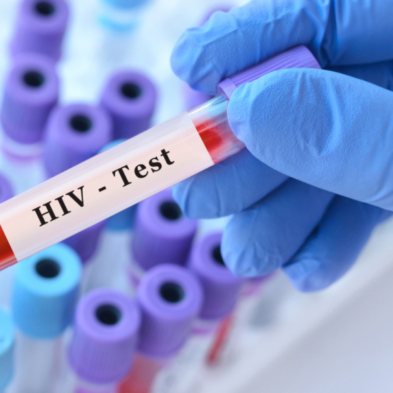 Alarm svetskih stručnjaka: Zabrinjavajuća nestašica ključnih lekova za HIV