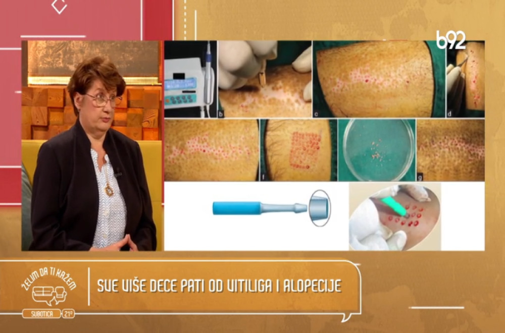 Želim da ti kažem - dr Jasmina Kozarev, specijalista dermatovenerologije i laserske medicine